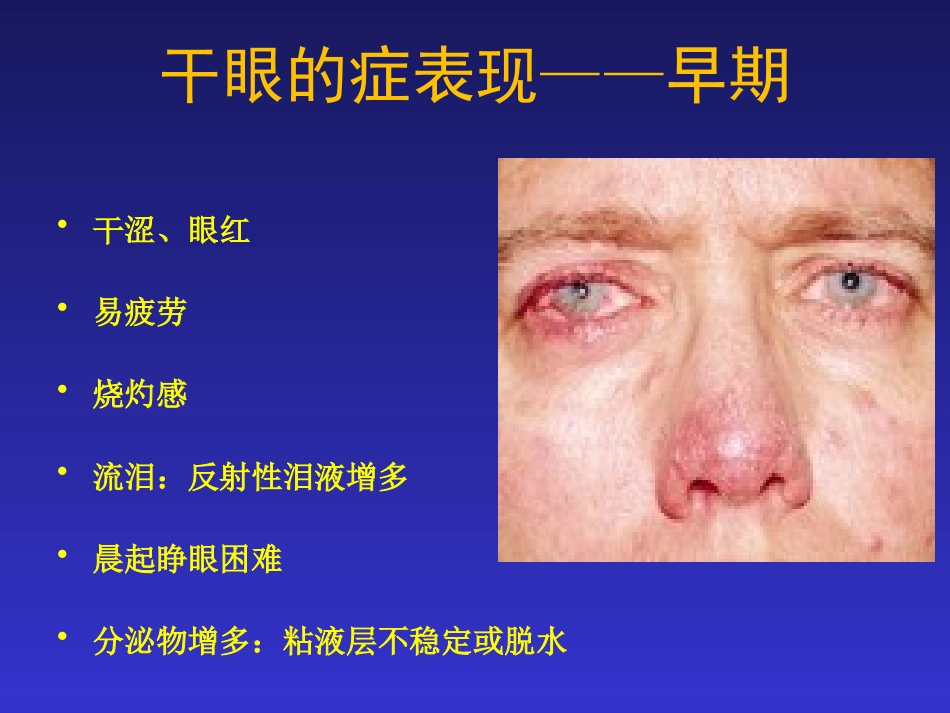 干眼症的防治_第5页