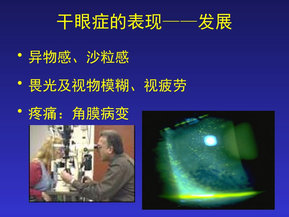 干眼症的防治_第6页