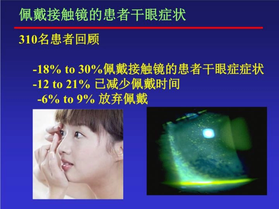 干眼症的防治_第9页
