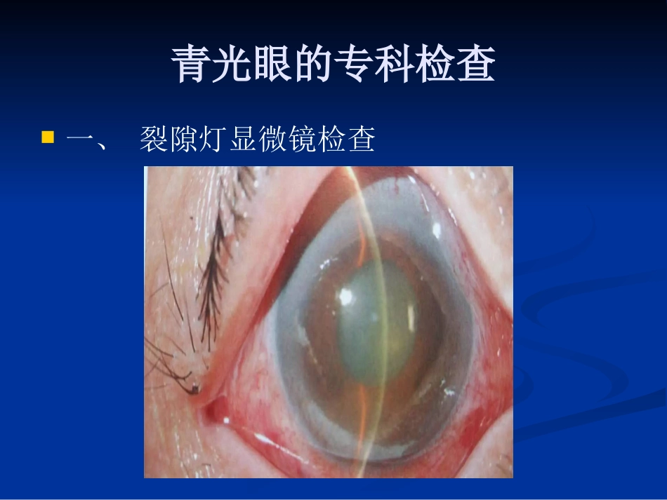 急性闭角型青光眼的诊断与治疗剖析_第15页
