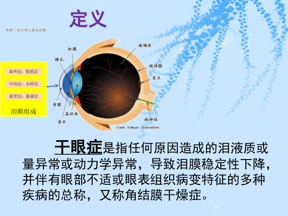 干眼症的预防与护理_第3页