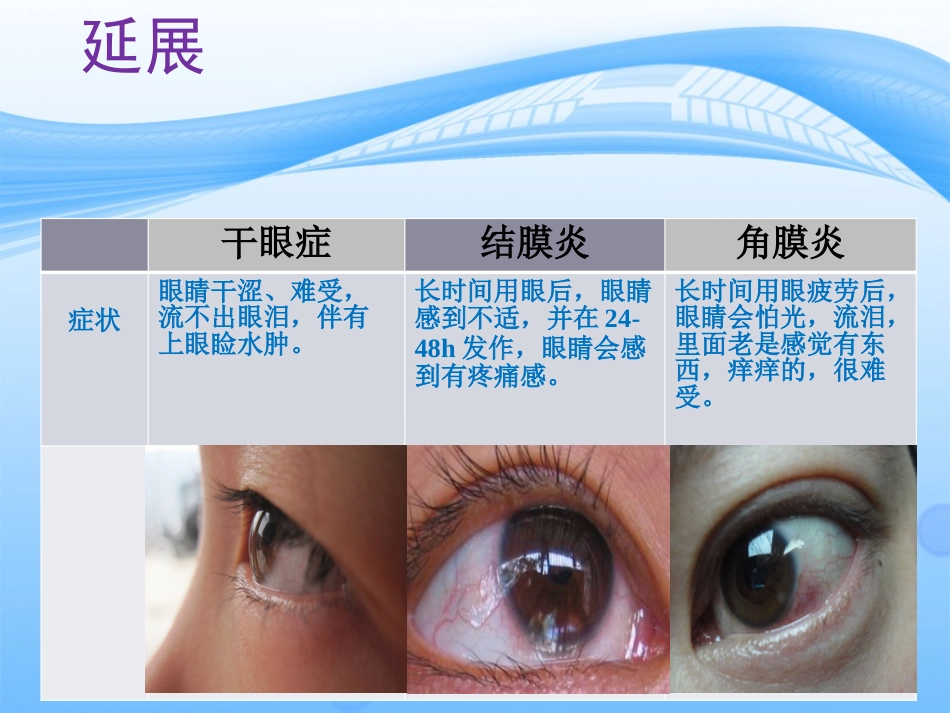 干眼症的预防与护理_第9页