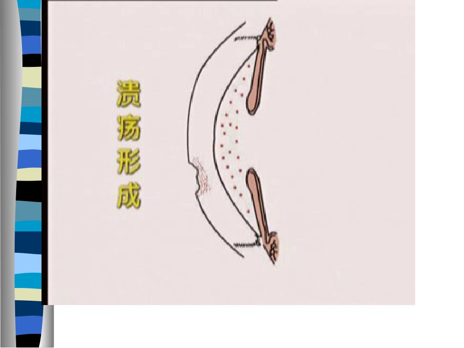 角膜病护理PPT课件_第6页