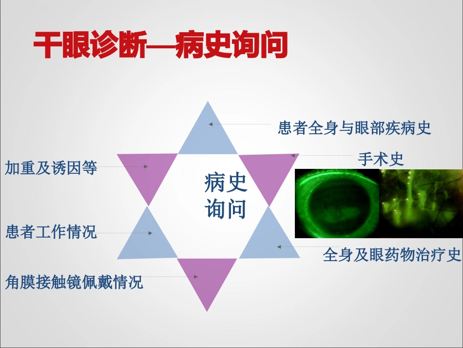 干眼临床诊疗规范_第11页