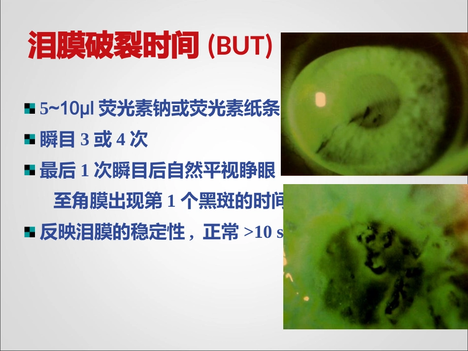 干眼临床诊疗规范_第15页