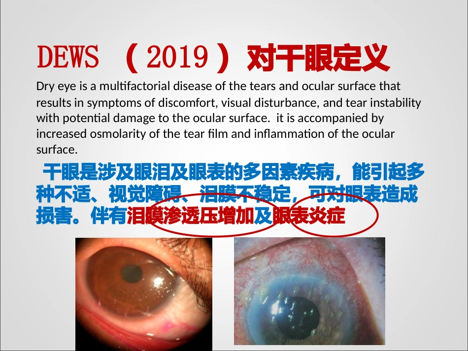 干眼临床诊疗规范_第5页