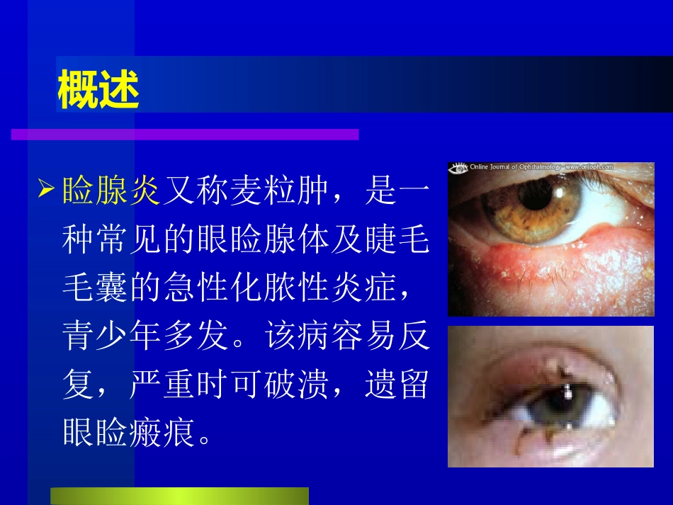 睑腺炎-麦粒肿_第3页