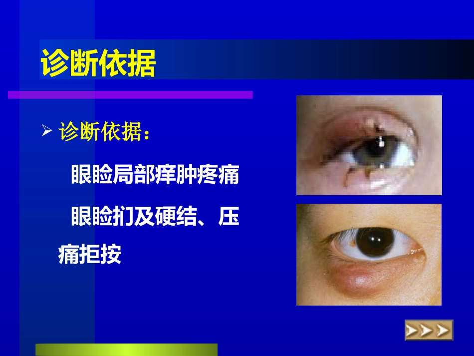 睑腺炎-麦粒肿_第9页