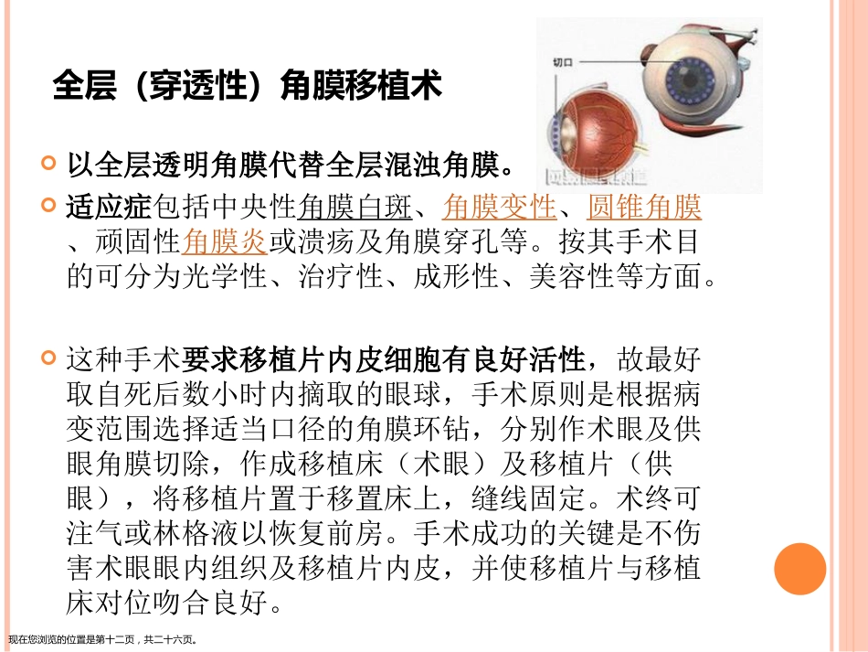 角膜移植术_第12页