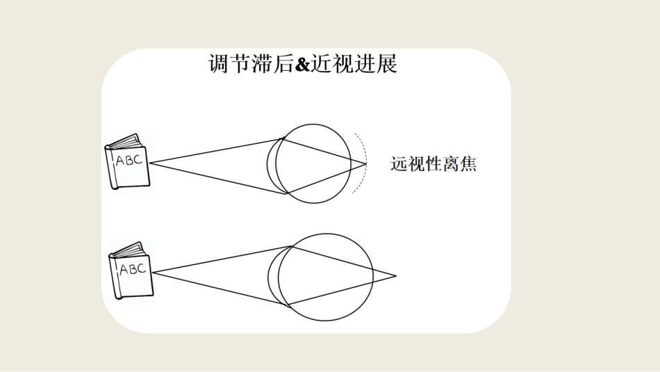 角膜塑形术后调节及双眼视功能改变_第8页