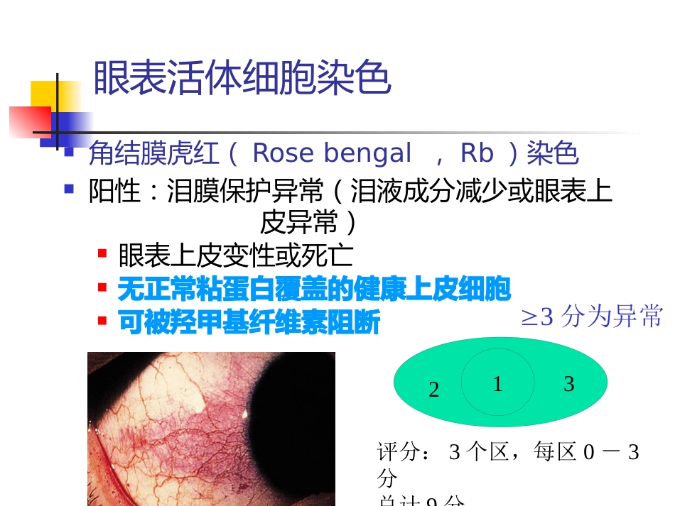 干眼诊断及治疗新进展讲义北京_第10页