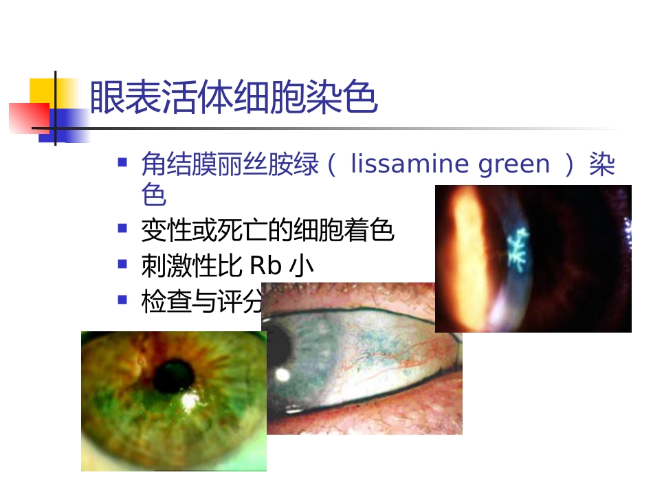 干眼诊断及治疗新进展讲义北京_第11页