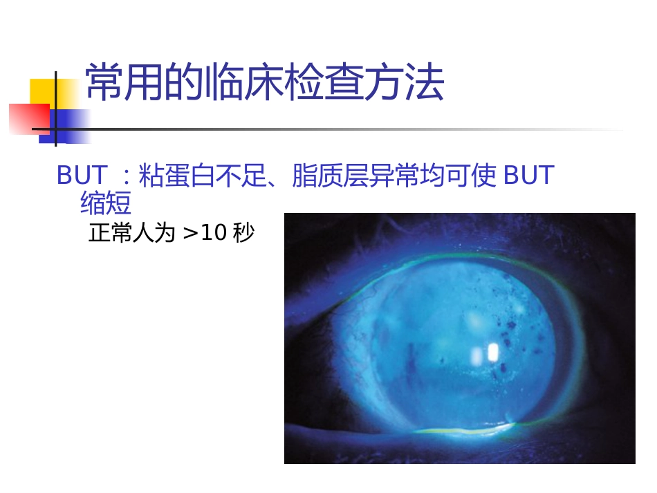 干眼诊断及治疗新进展讲义北京_第7页