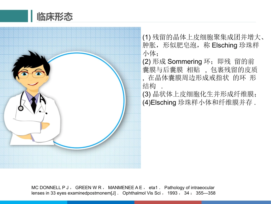 后发性白内障_第9页