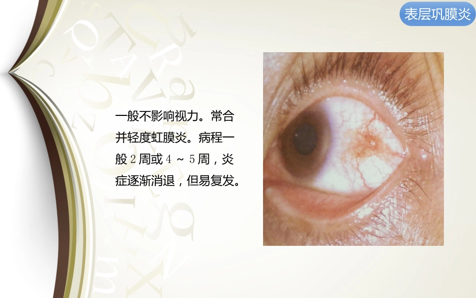 巩膜炎分享资料_第9页