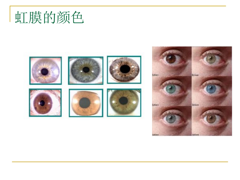 感觉器-眼_第11页