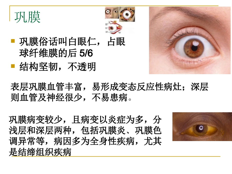 感觉器-眼_第8页