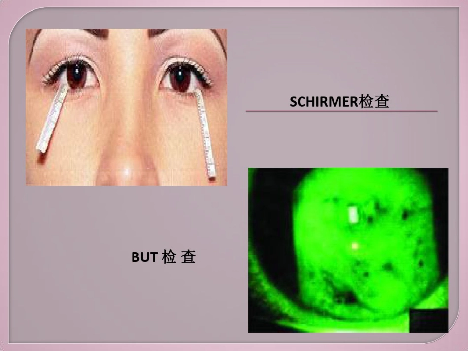干眼症介绍及治疗健康教育讲座_第10页