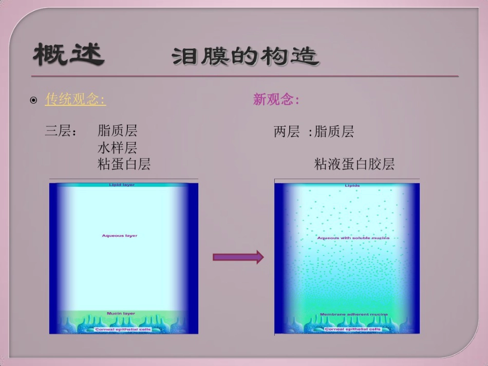 干眼症介绍及治疗健康教育讲座_第3页