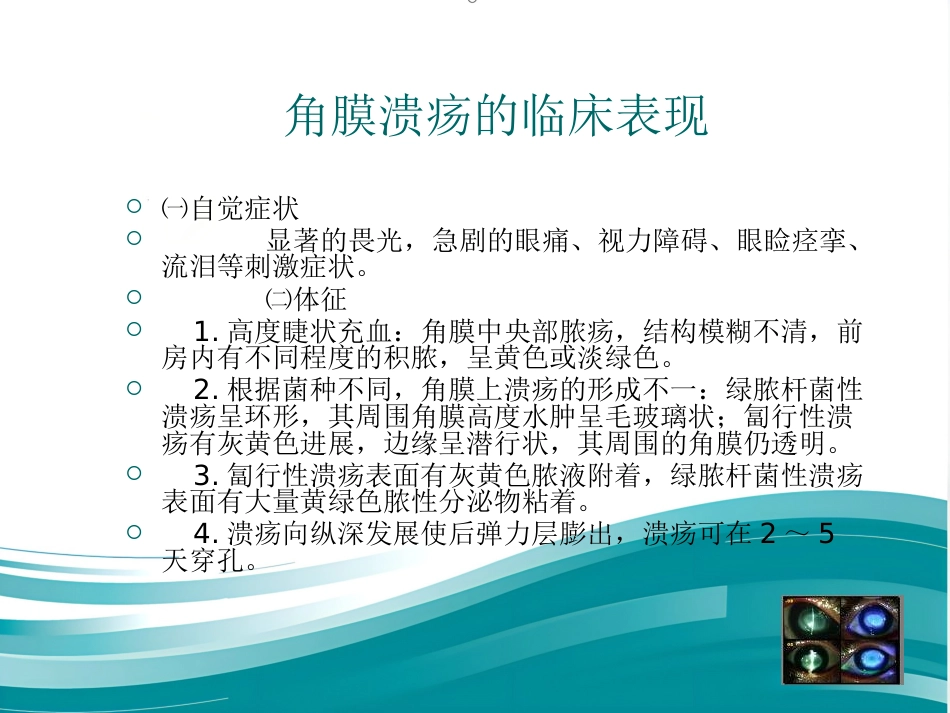 角膜炎教学查房_第12页