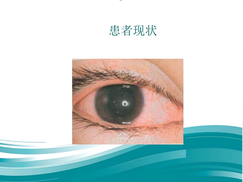 角膜炎教学查房_第6页