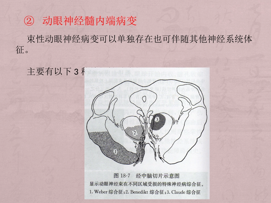 核性和核下性眼球运动障碍_第11页
