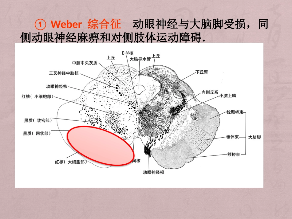 核性和核下性眼球运动障碍_第12页
