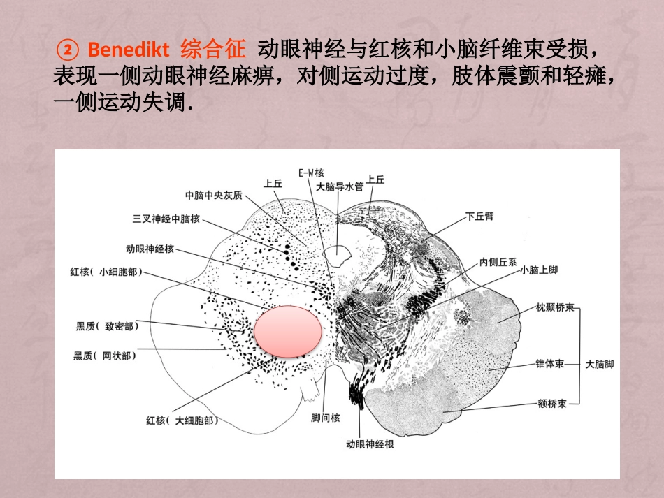 核性和核下性眼球运动障碍_第14页