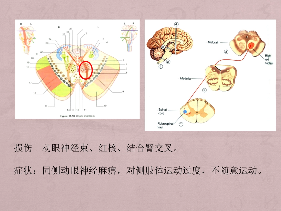 核性和核下性眼球运动障碍_第15页
