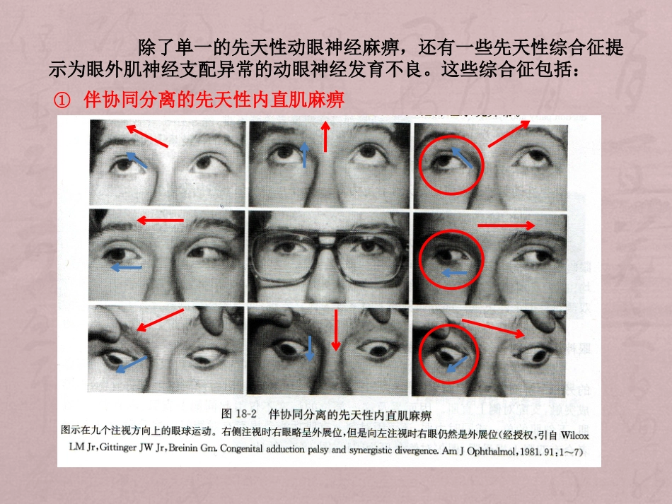 核性和核下性眼球运动障碍_第7页