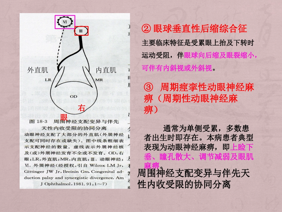 核性和核下性眼球运动障碍_第8页