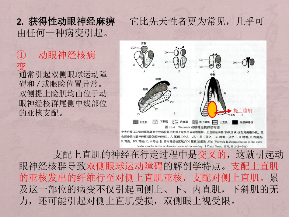 核性和核下性眼球运动障碍_第9页