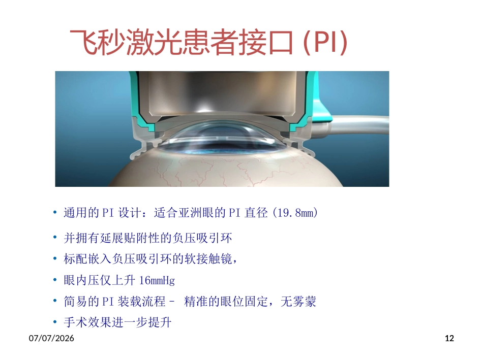 飞秒激光辅助白内障超声乳化联合toricIOL联合术分析_第12页