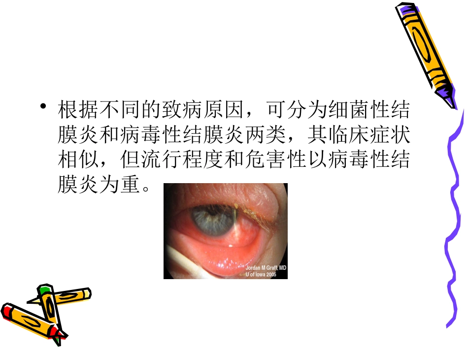 急性出血性结膜炎_第4页