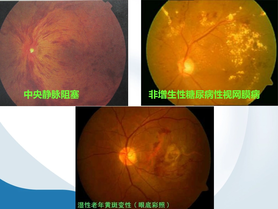 简析视网膜结构_第13页