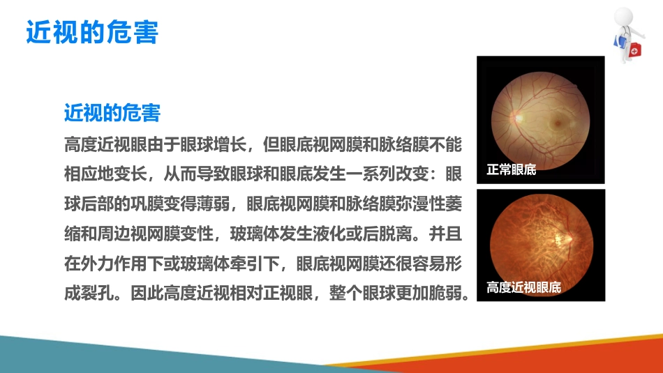 儿童眼保健 近视眼的预防与保健_第3页