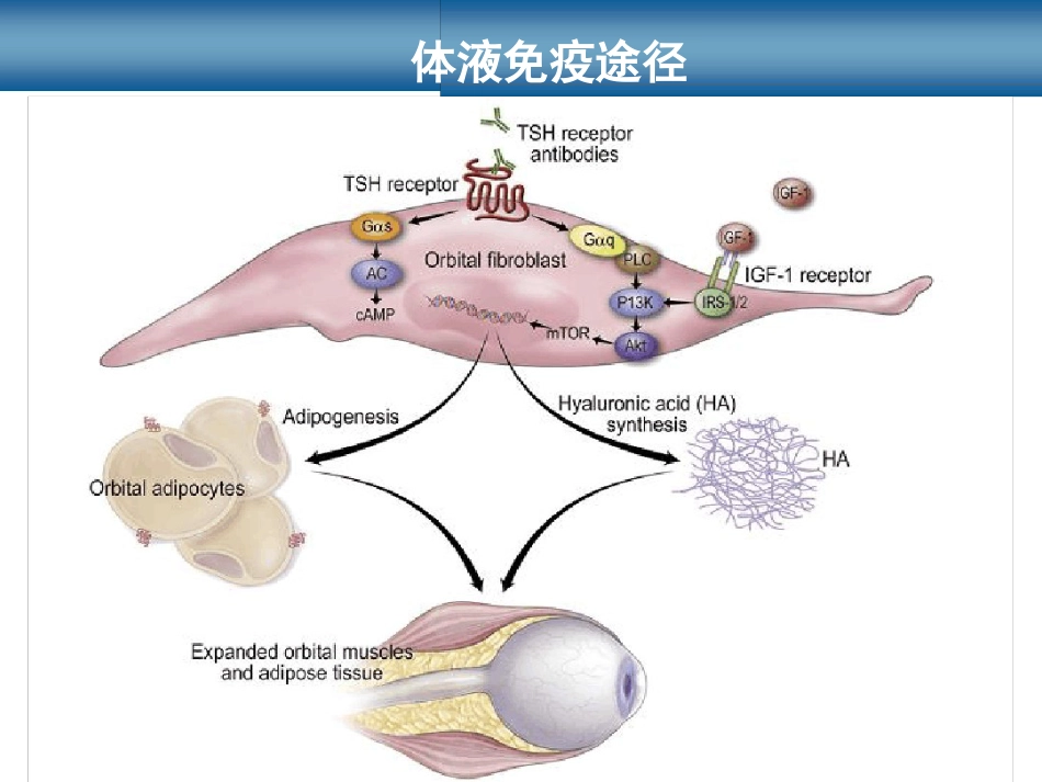 甲状腺相关性眼病_第10页