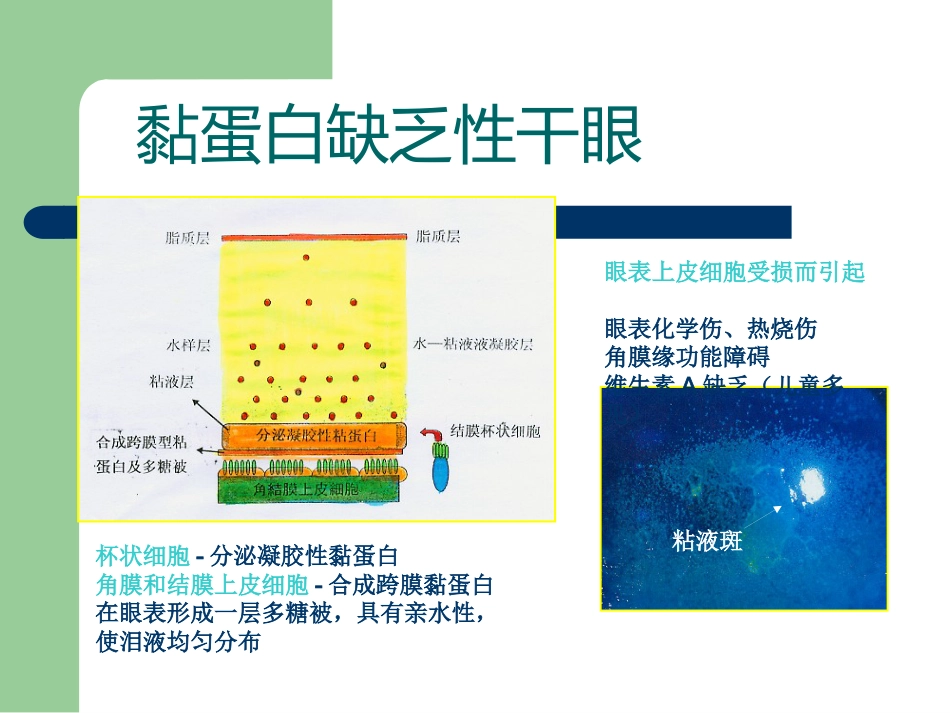 干眼症_第10页