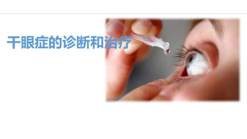 干眼症PPT课件(1)