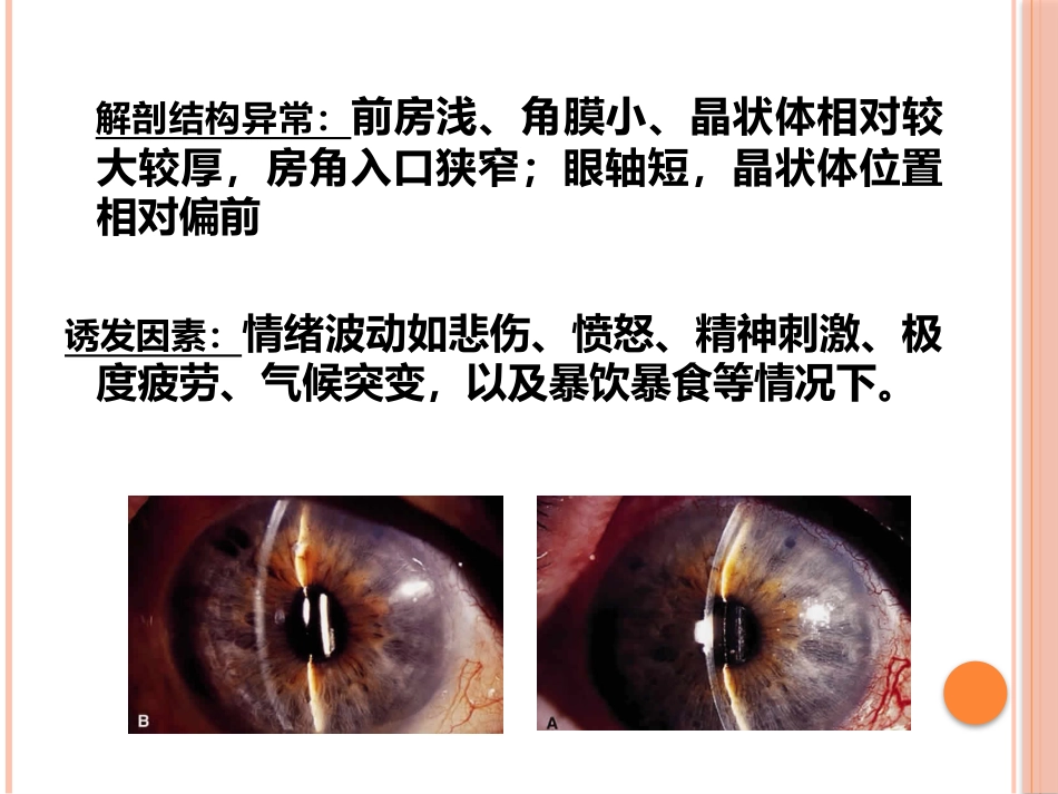 急性闭角型青光眼(1)_第10页