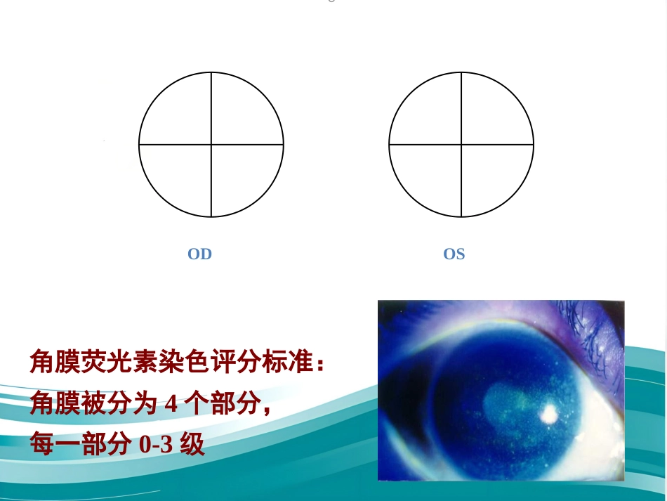 干眼症(1)_第13页