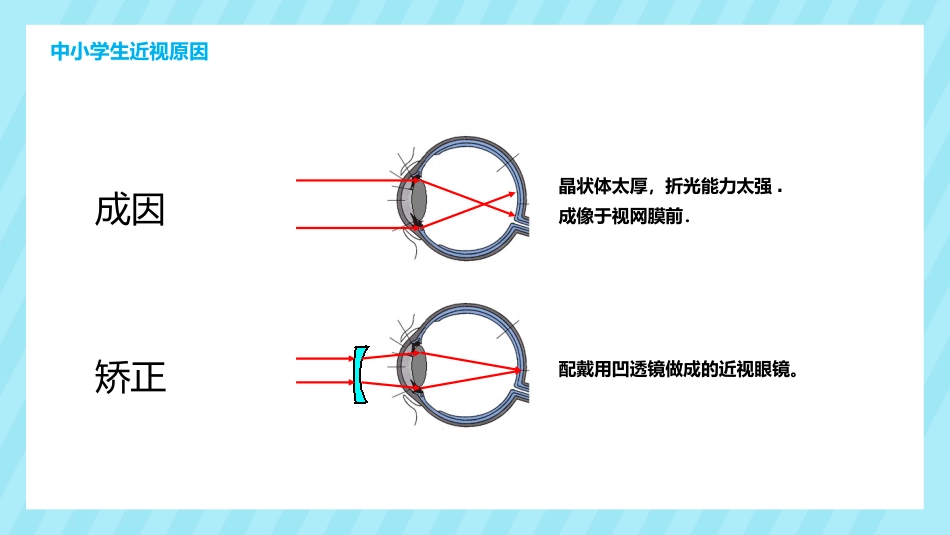 关注眼睛健康主题教育PPT课件(3款)_第7页