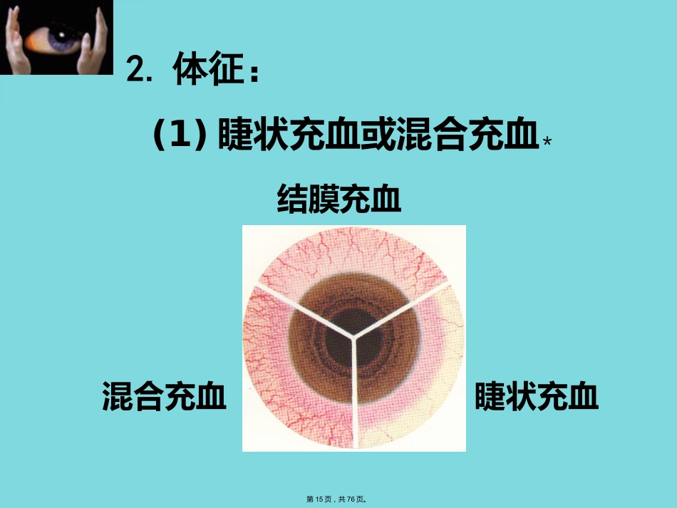 角膜病 (4)_第15页