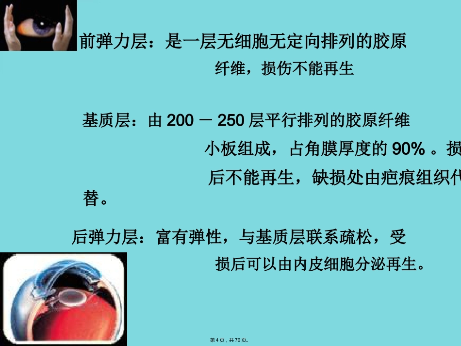 角膜病 (4)_第4页