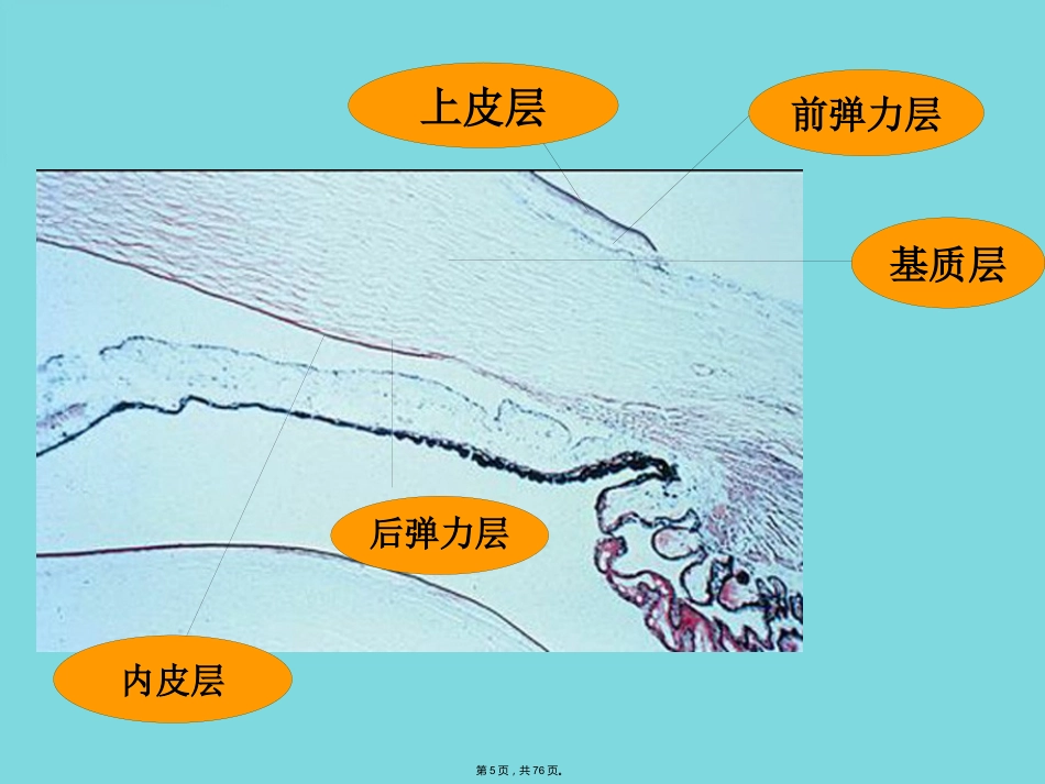 角膜病 (4)_第5页