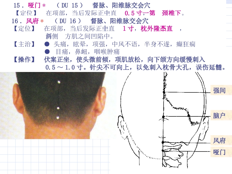 人体经络穴位图谱13督脉_第13页