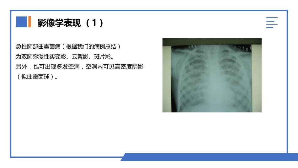 肺部真菌感染_第9页