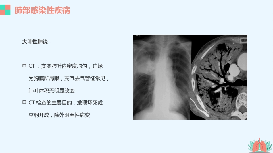 肺部疾病的影像学诊断_第6页