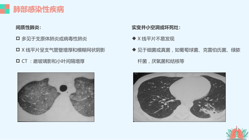 肺部疾病的影像学诊断_第8页