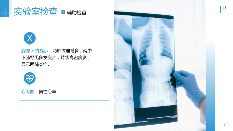 肺部感染的个案护理_第11页